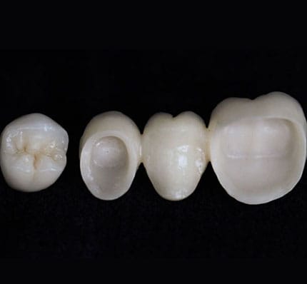Crown