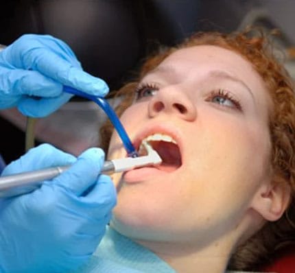 Gums Periodontal Health