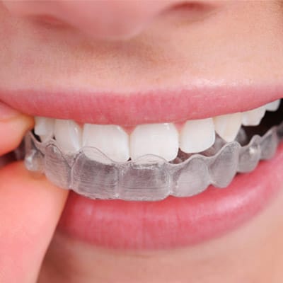 Service - Preventative Dentistry
