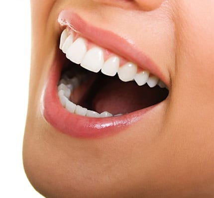 Teeth Whitening