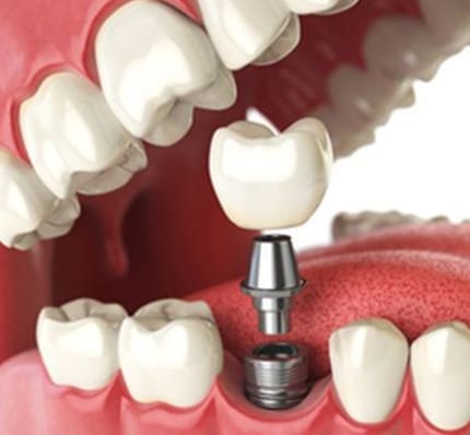 dental im